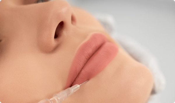 Lip Enhancement with Restylane