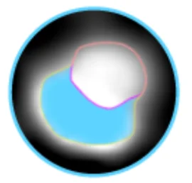 Calcified Plaque Testosteronology.com