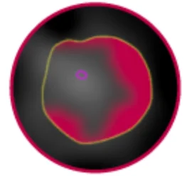 Low Density Plaque Testosteronology.com